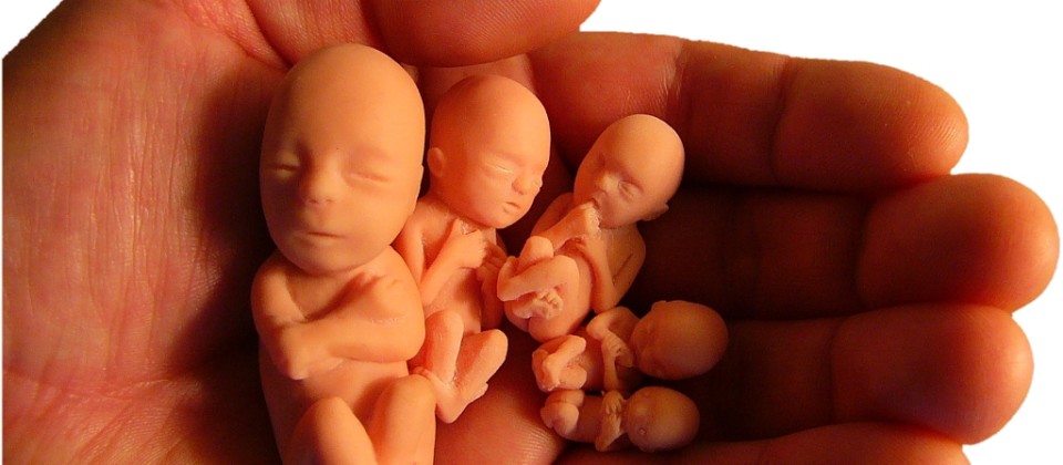 A industria do Aborto – uma vergonha
